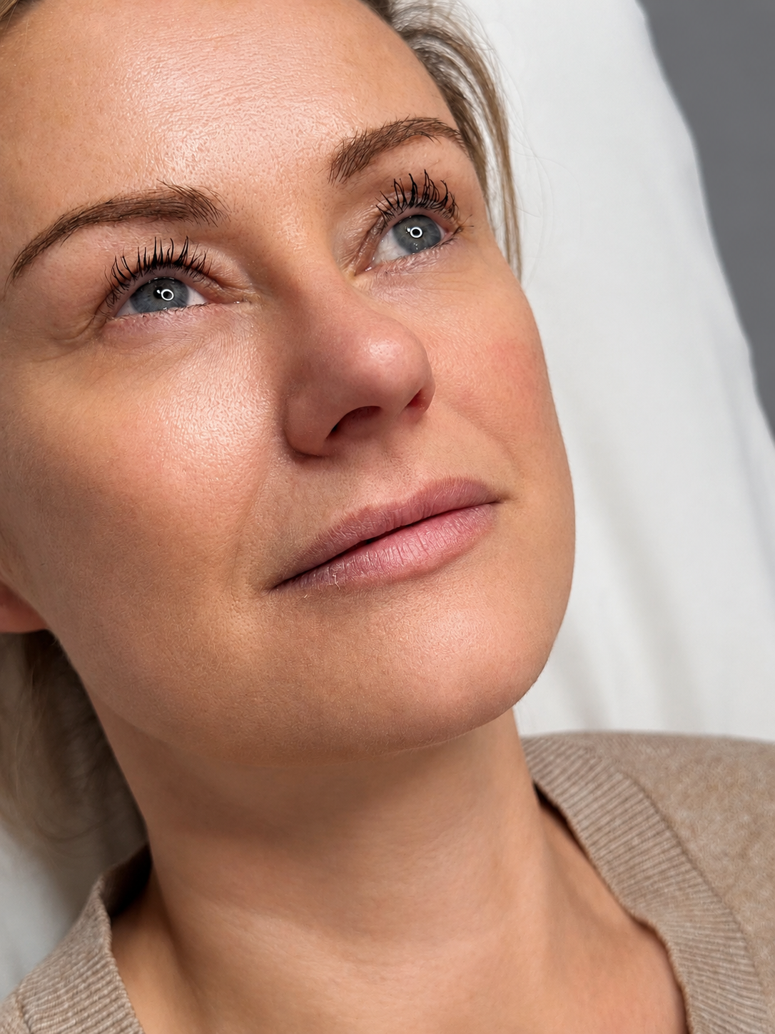 Before lip filler treatment
